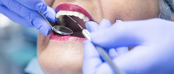 Best Chipped Tooth Repair Near Me  in Durant, MS